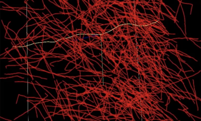 Πώς το NeuroTrALE αλλάζει τη μελέτη του εγκεφάλου