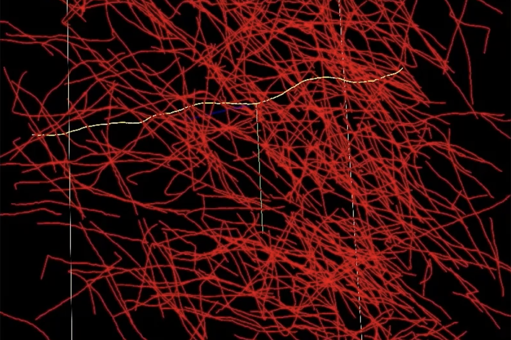 Πώς το NeuroTrALE αλλάζει τη μελέτη του εγκεφάλου