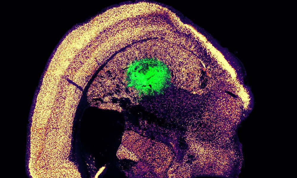 MIT: Μετατροπή κυττάρων δέρματος σε νευρώνες