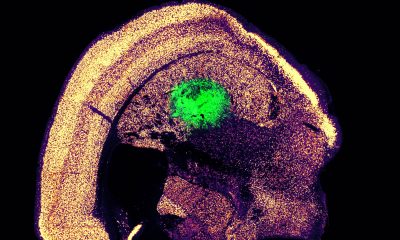 MIT: Μετατροπή κυττάρων δέρματος σε νευρώνες
