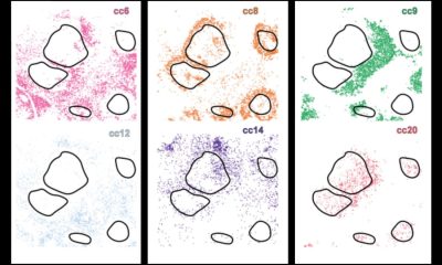 Νέο σύστημα AI αποκαλύπτει κρυφούς κυτταρικούς υποτύπους