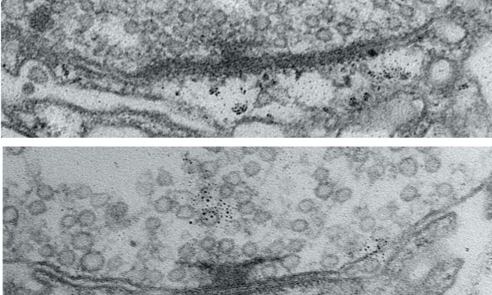 Πώς η νευρωνική δραστηριότητα ωριμάζει τις συνάψεις