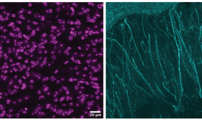 Two projection images of a neuronal cell nuclei (left) and dendrites (right) or branched extensions of a nerve cell.